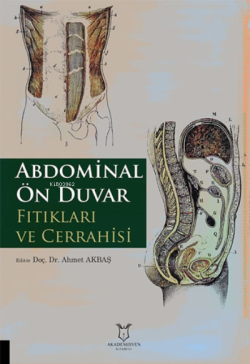 Abdominal Ön Duvar Fıtıkları ve Cerrahisi - Ahmet Akbaş | Yeni ve İkin