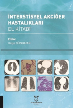 İnterstisyel Akciğer Hastalıkları El Kitabı - Kolektif | Yeni ve İkinc