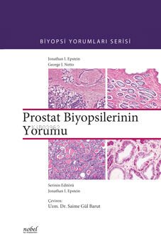 Prostat Biyopsilerinin Yorumu