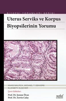 Uterus Serviks ve Korpus Biyopsilerinin Yorumu