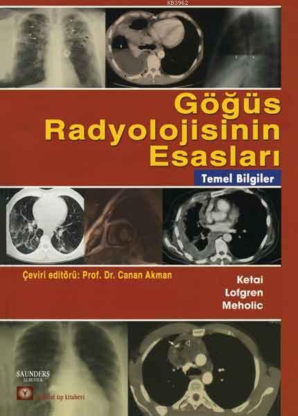 Göğüs Radyolojisinin Esasları - | Yeni ve İkinci El Ucuz Kitabın Adres
