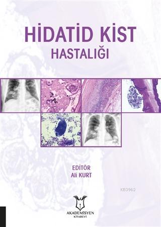 Hidatid Kist Hastalığı - Ali Kurt | Yeni ve İkinci El Ucuz Kitabın Adr